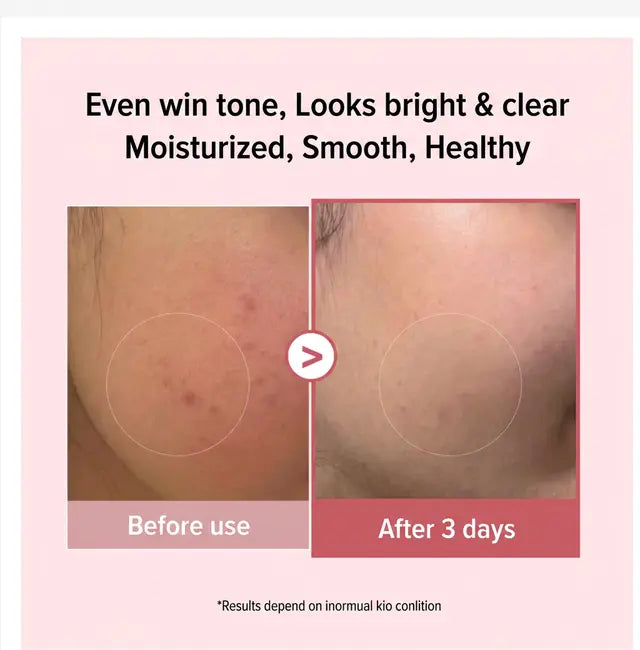 MEDICUBE PDRN Pink Collagen Capsule Cream, Korean Capsule Cream for Radiant Glass Skin