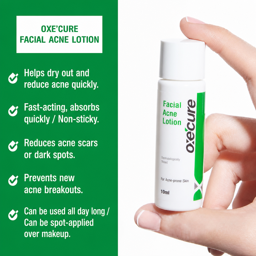 Oxe'Cure Facial Acne Lotion – Salicylic Acid Spot Care