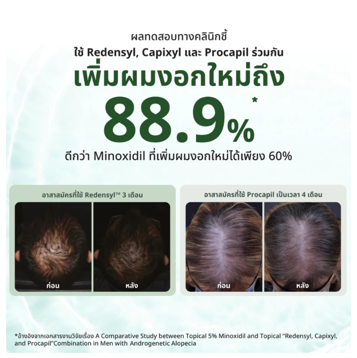 AloEx Organic Intensive Hair Serum Lightweight Scalp & Hair Care Formula