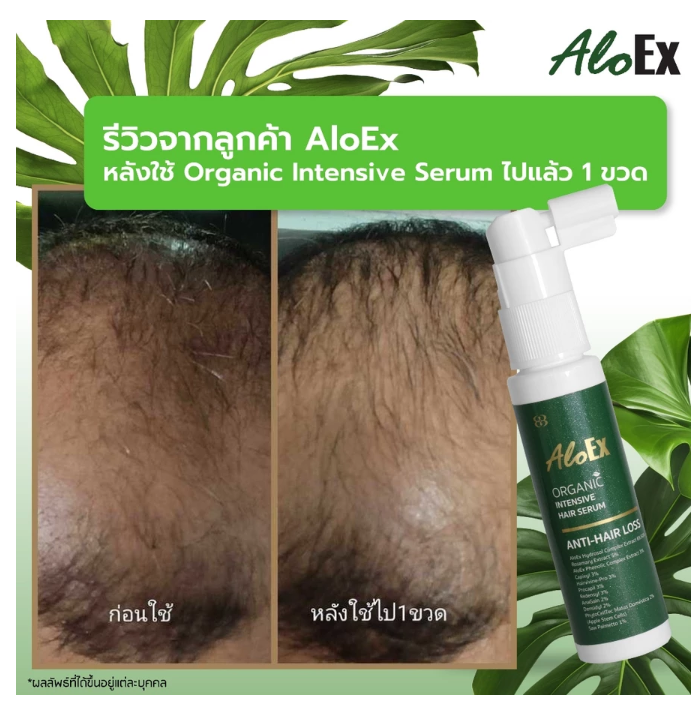 AloEx Organic Intensive Hair Serum Lightweight Scalp & Hair Care Formula