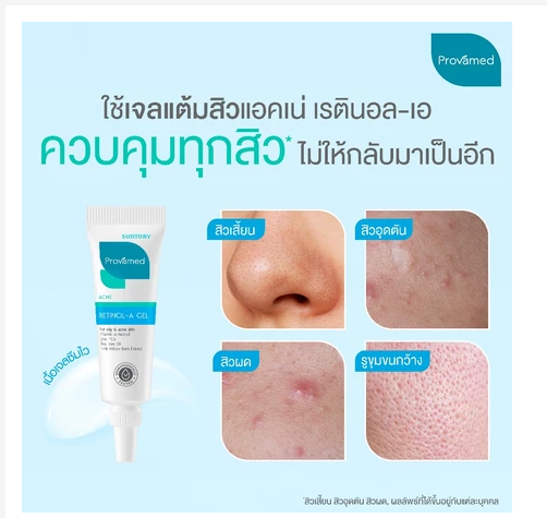 Acne Spot Treatment Retinol Gel Pimples Blackheads Oil Control Fast Action