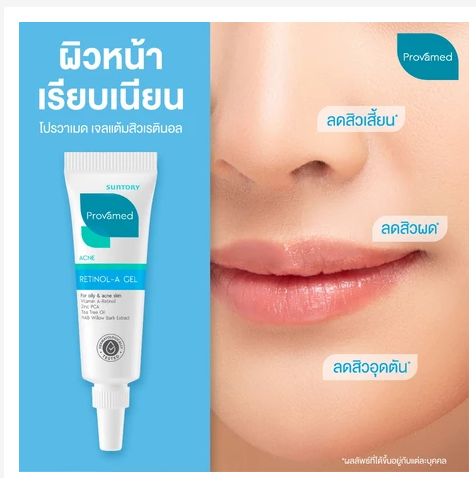 Acne Spot Treatment Retinol Gel Pimples Blackheads Oil Control Fast Action